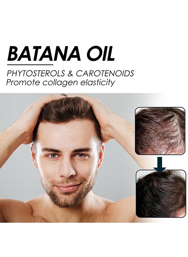 Batana Oil for Hair Growth Batana Oil - Batana Oil Organic for Healthy Hair - Repair Damaged Hair, Nourishes Thin Hair Scalp Skin and Loss Hair Growth Fir for All Hair Types, 30 ml