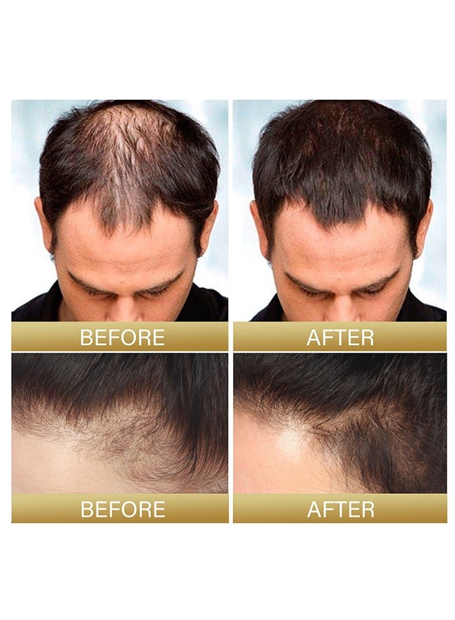 Batana Oil for Hair Growth Batana Oil - Batana Oil Organic for Healthy Hair - Repair Damaged Hair, Nourishes Thin Hair Scalp Skin and Loss Hair Growth Fir for All Hair Types, 30 ml