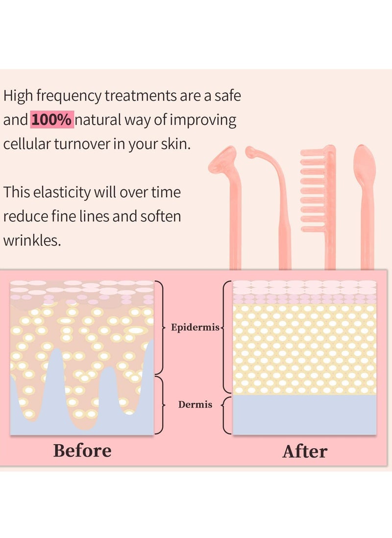 4 in 1 Portable High Frequency Skin Therapy Machine, Blemish & Spot Control, Skin Tightening & Radiance, Wrinkle Reducing Skin Therapy Wand with 4 Different Tubes