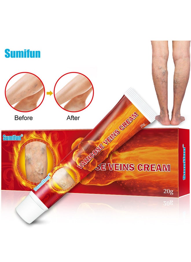 Varicose Veins Cream 20G, Phlebitis Spider Pain Relief Balm, Relieve Swelling And Pain, Improve Blood Circulation, Venous Health Ointment, Soothes Tired Legs