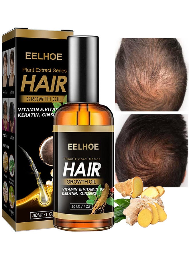 Plant Extract Hair Growth Oil, Ginger Essential Oil Hair Growth, For Hair Loss, Hair Grow Thicker And Longer, Fast Hair Growth