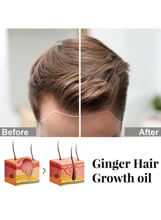 Plant Extract Hair Growth Oil, Ginger Essential Oil Hair Growth, For Hair Loss, Hair Grow Thicker And Longer, Fast Hair Growth