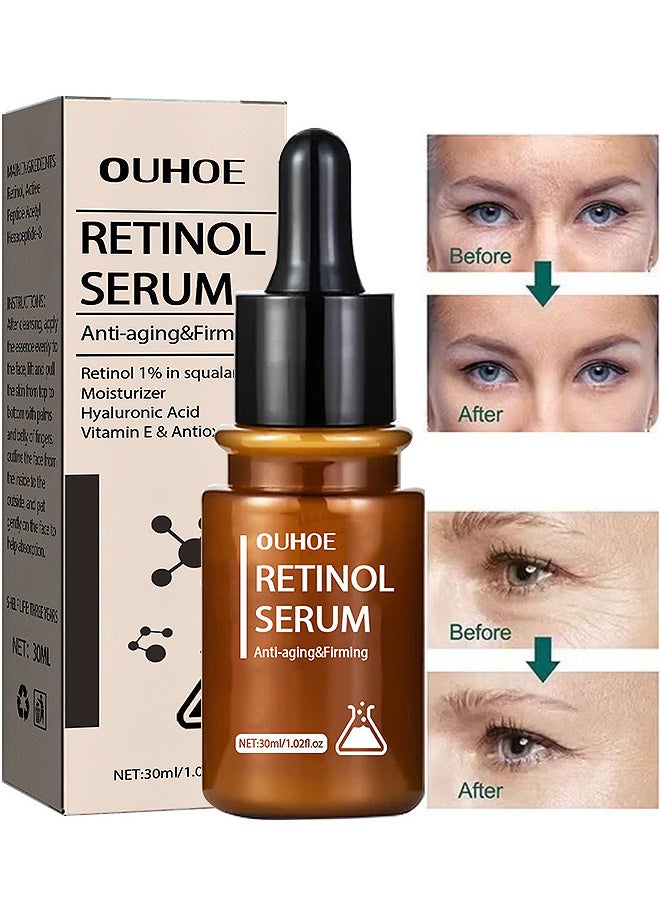 Anti-Aging And Firming Retinol Serum, Vitamine E And Antioxidants Hyaluronic Acid Anti-Aging Serum, Reduces Wrinkles, Fine Lines, Age Spots, Sun Spots, Anti Wrinkle Facial Serum 30ML