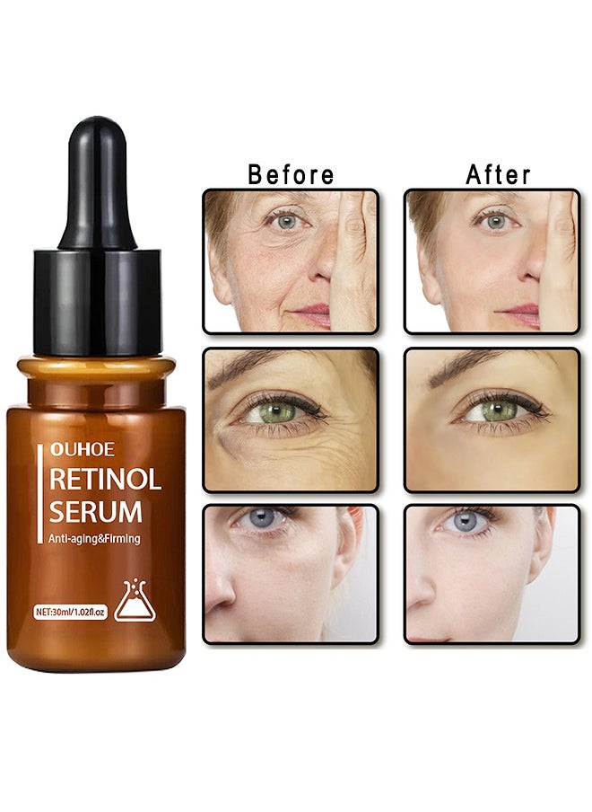 Anti-Aging And Firming Retinol Serum, Vitamine E And Antioxidants Hyaluronic Acid Anti-Aging Serum, Reduces Wrinkles, Fine Lines, Age Spots, Sun Spots, Anti Wrinkle Facial Serum 30ML