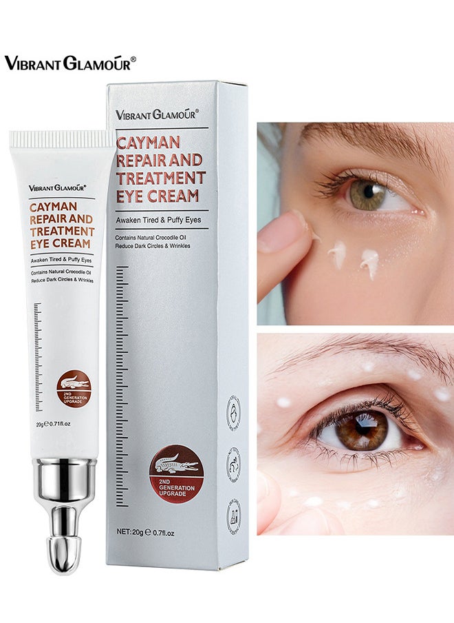 Cayman Repair And Treatment Eye Cream 20G, Magic Eye Cream, Eye Cream To Remove Eye Bags, Wrinkles, Fine Lines, Dark Circles, Anti Aging Eye Cream, Lift Lighten Eye Cream, Eye Repair And Treatment