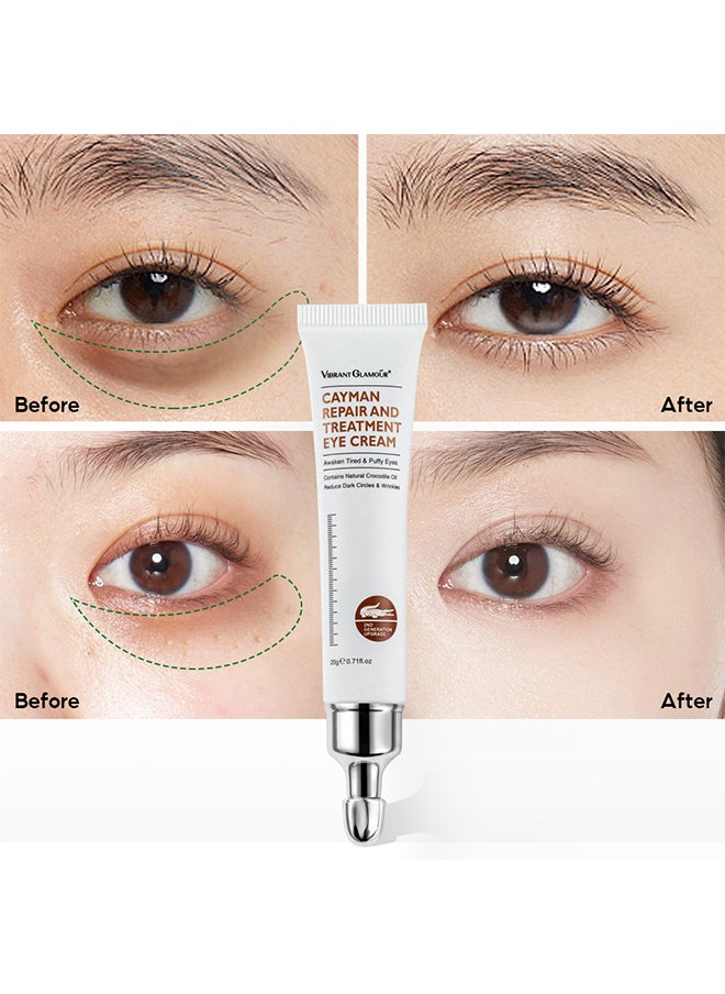 Cayman Repair And Treatment Eye Cream 20G, Magic Eye Cream, Eye Cream To Remove Eye Bags, Wrinkles, Fine Lines, Dark Circles, Anti Aging Eye Cream, Lift Lighten Eye Cream, Eye Repair And Treatment