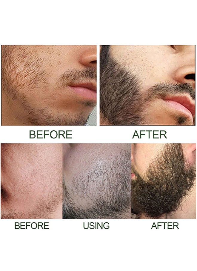 Beard Growth Serum Hyper Derma Roller, Men Rosemary Oil Moustache Growth Enhancer ​Anti Hair Loss Care Serum With Beard Rolle 60ML