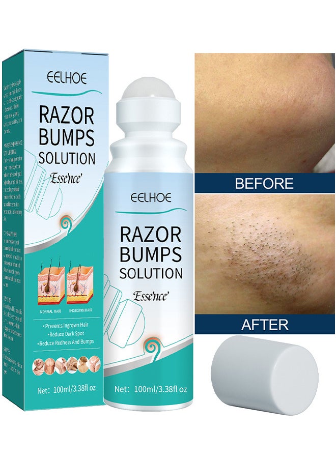 Razor Bump Solution Essence, Prevents Ingrown Hair Reduce Dark Spot Reduce Redhess And Bumps, Hair Growth Inhibitor Safe And Gentle, Delay Hair Growth, No Black Spots, Roll-On 100ML