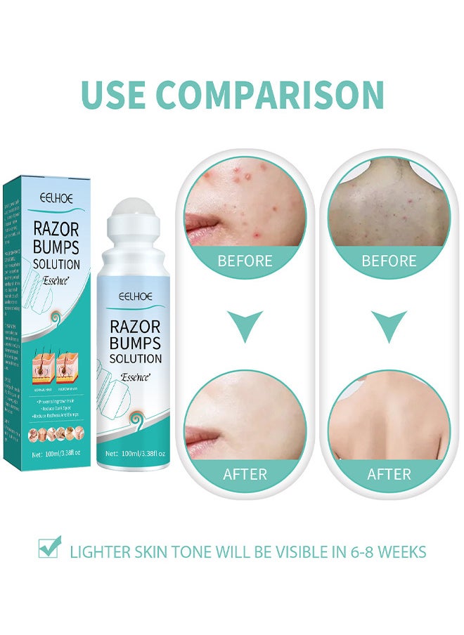 Razor Bump Solution Essence, Prevents Ingrown Hair Reduce Dark Spot Reduce Redhess And Bumps, Hair Growth Inhibitor Safe And Gentle, Delay Hair Growth, No Black Spots, Roll-On 100ML