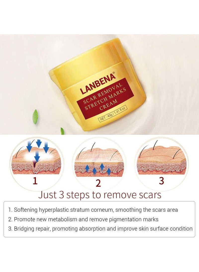 LANBENA Acne Scar Removal Cream Acne Repairing Scar Gel for Surgical Scars, Scars, Burns, Stretch Marks, Acne Spots, Fade Scar Melanin Acne Marks Pock Skin Care, Herbal Scar Cream Face Skin Repair