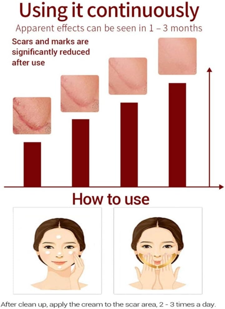 LANBENA Acne Scar Removal Cream Acne Repairing Scar Gel for Surgical Scars, Scars, Burns, Stretch Marks, Acne Spots, Fade Scar Melanin Acne Marks Pock Skin Care, Herbal Scar Cream Face Skin Repair