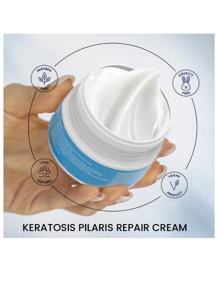 Cleansing Keratosis Pilaris Lotion Chicken Skin Removal Skin Moisturizer And Acne Repair Body Refreshing Cream Fast Effective Relief Restoring Body Lotion for Daily and Night Body Use 30G