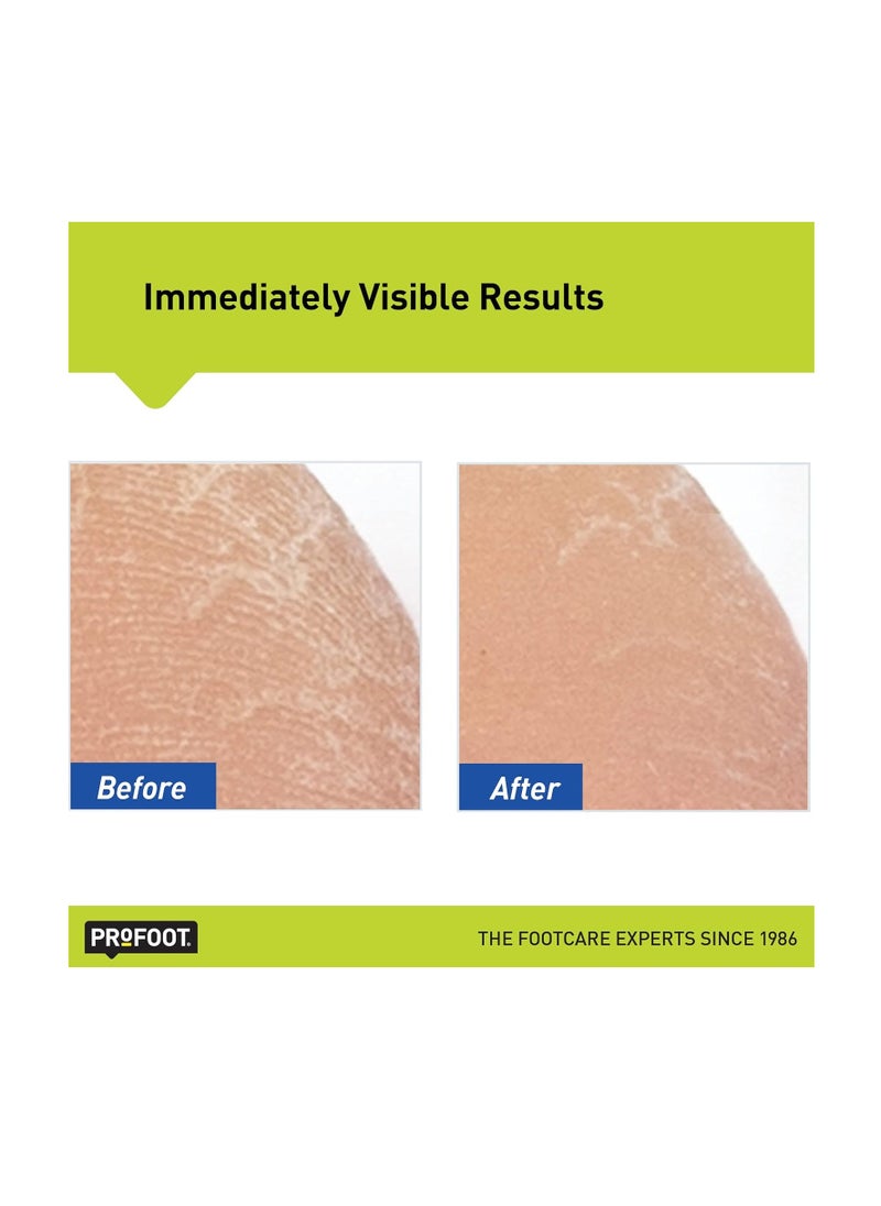 Profoot Heel Rescue Foot Cream 16 Ounce Bottle, 2 Pack, for Cracked, Calloused or Chapped Skin