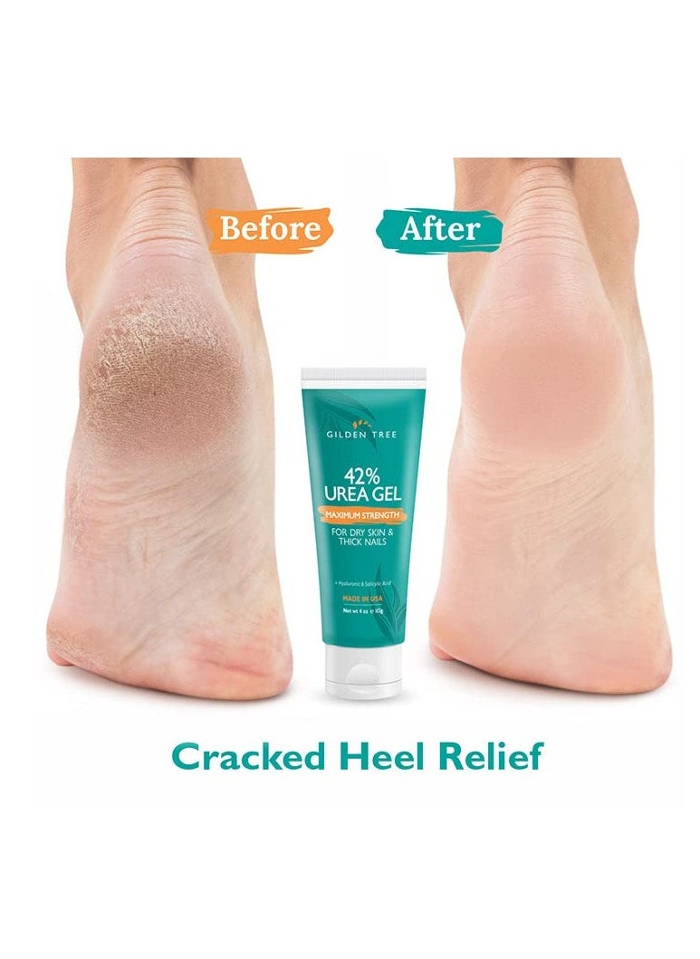 Urea Gel 42 Percent For Feet Maximum Strength Softens Cracked Heel Calluses & Thick Toenails