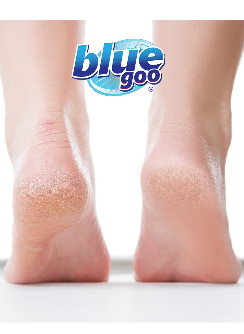 Blue Goo Cracked Heels & Dry Hands Intense Skin Softener - for Calluses, Corns & Elbow Dryness Relief, Fast- Penetrating Hydrating Moisturizer, Made w/ 100% Pure Emu Oil & Beeswax, 2 oz (2 Pack)