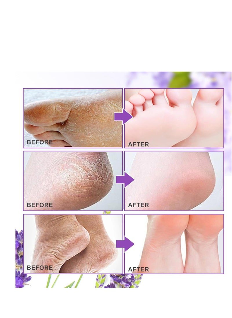 ALIVER Foot Peel Mask 3 Pack, Exfoliator Peel Off Calluses Dead Skin Callus Remover, Baby Soft Smooth Touch Feet-Men Women (Lavender)