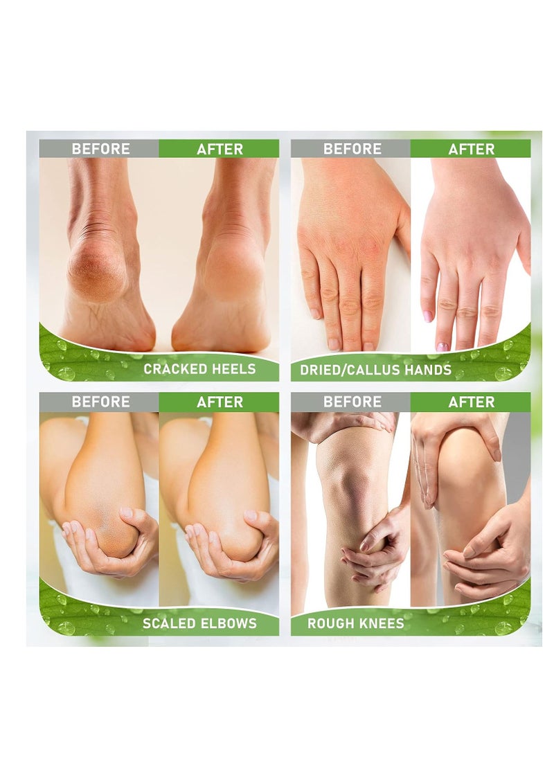 Urea Cream 42% - 2% Salicylic Acid Foot Moisturizer - Callus & Dead Skin Remover, Repairing Foot File, 3.5 oz