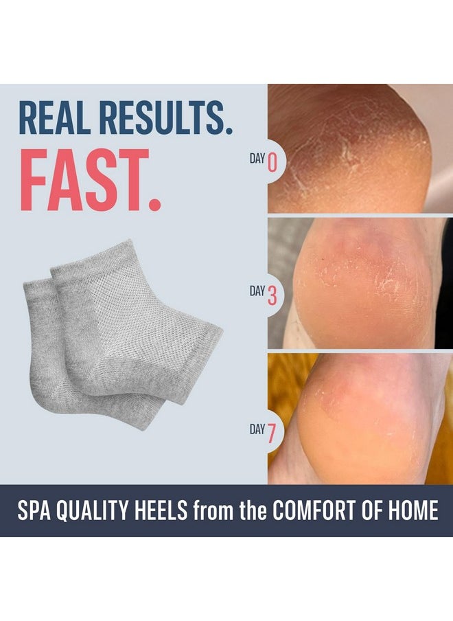Moisturizing Heel Socks For Cracked Heel Treatment 2 Pairs Stop Cracked Heels In Their Tracks