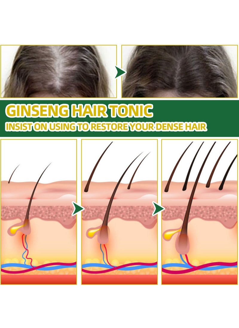 OUHOE Ginseng Hair Thickening Liquid Ginseng Essence Spray to Prevent Hair Loss Strengthen and Moisturize Hair