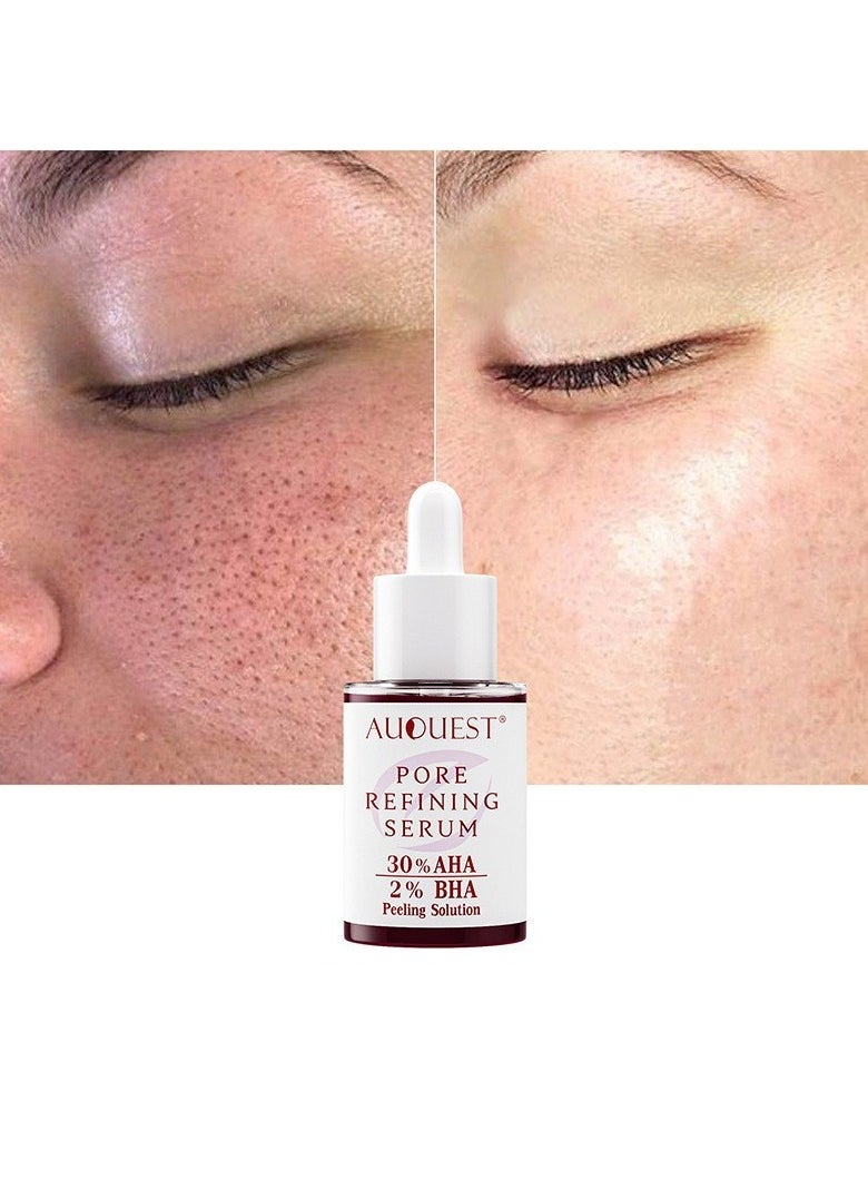 Facial Pore Shrinking Essence Hydrating and Moisturizing Facial Acne Marks and Pimples Care