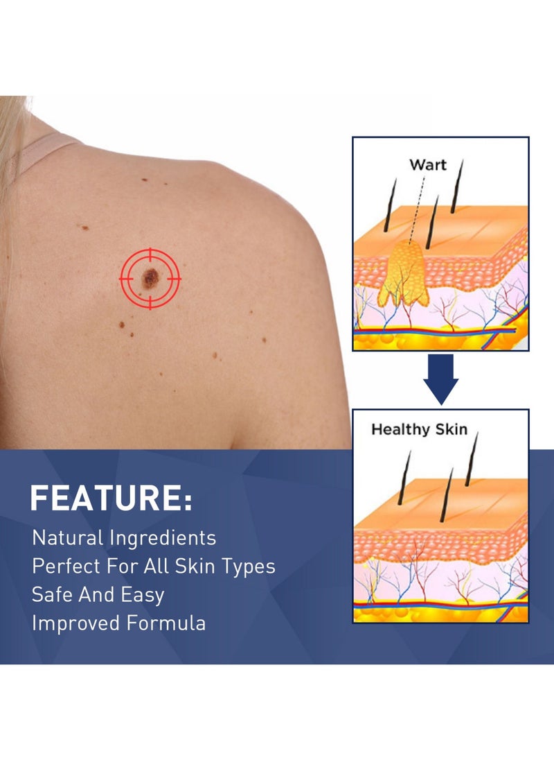 Jaysuing Wart Killing Agent for Skin Treatment for Chickens and Humans Including Eye Warts Flat Plantar Wart Clearing Liquid for Neck and Flesh Particles