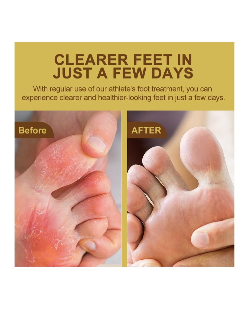 Athletes Foot Cream Athlete's Foot Odor Foot Cream Antifungal Cream Antibacterial Cream For Athletes' Foot Sterilization Treatment Anti-infection Foot Care Repair 20g