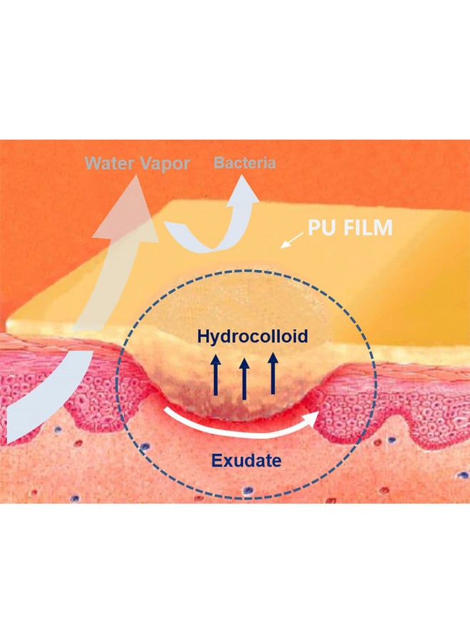 Hydrocolloid Adhesive Bandage, Hydrocolloid Wound Dressing Thin Type 4'' x 4'', Individually Sterile Packed Hydrocolloid Patches, Box of 10 Dressings