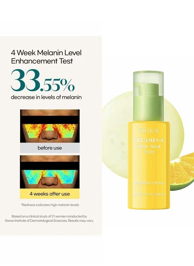 Green Tangerine Vitamin C Serum,Niacinamide acid Help Fade Sun Spots and Dark Spot,For Face & Neck and Eye Care Organic Anti-Aging Serum (30ml)