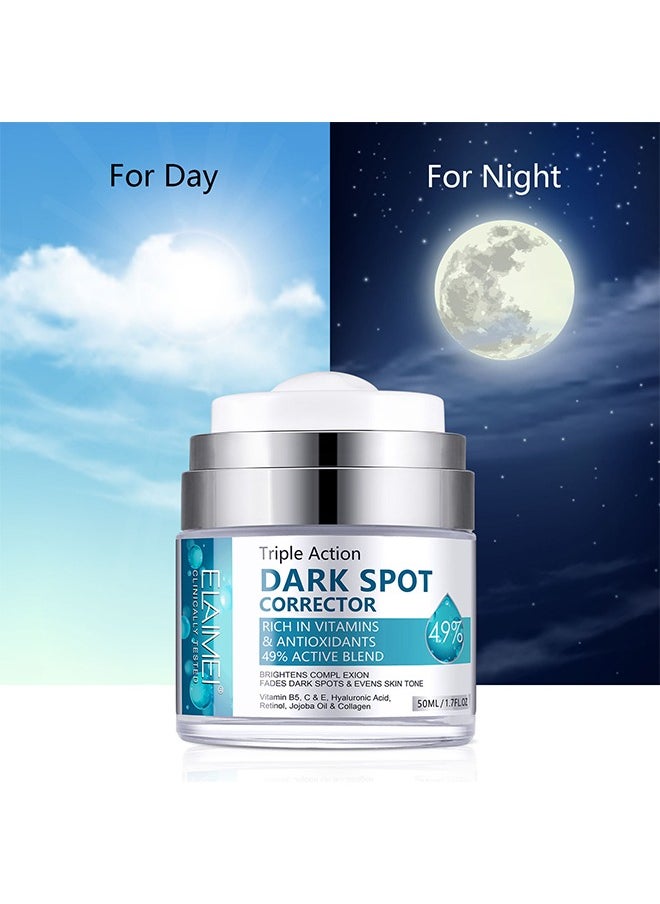 White Spot Cream, Whitening Freckle Cream Remove Melasma Cream, Dark Spot Remover for Face Hyperpigmentation, Smooth Skin Face Moisturizer Cream for All Skin Types