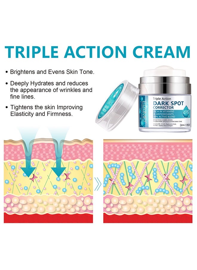 White Spot Cream, Whitening Freckle Cream Remove Melasma Cream, Dark Spot Remover for Face Hyperpigmentation, Smooth Skin Face Moisturizer Cream for All Skin Types