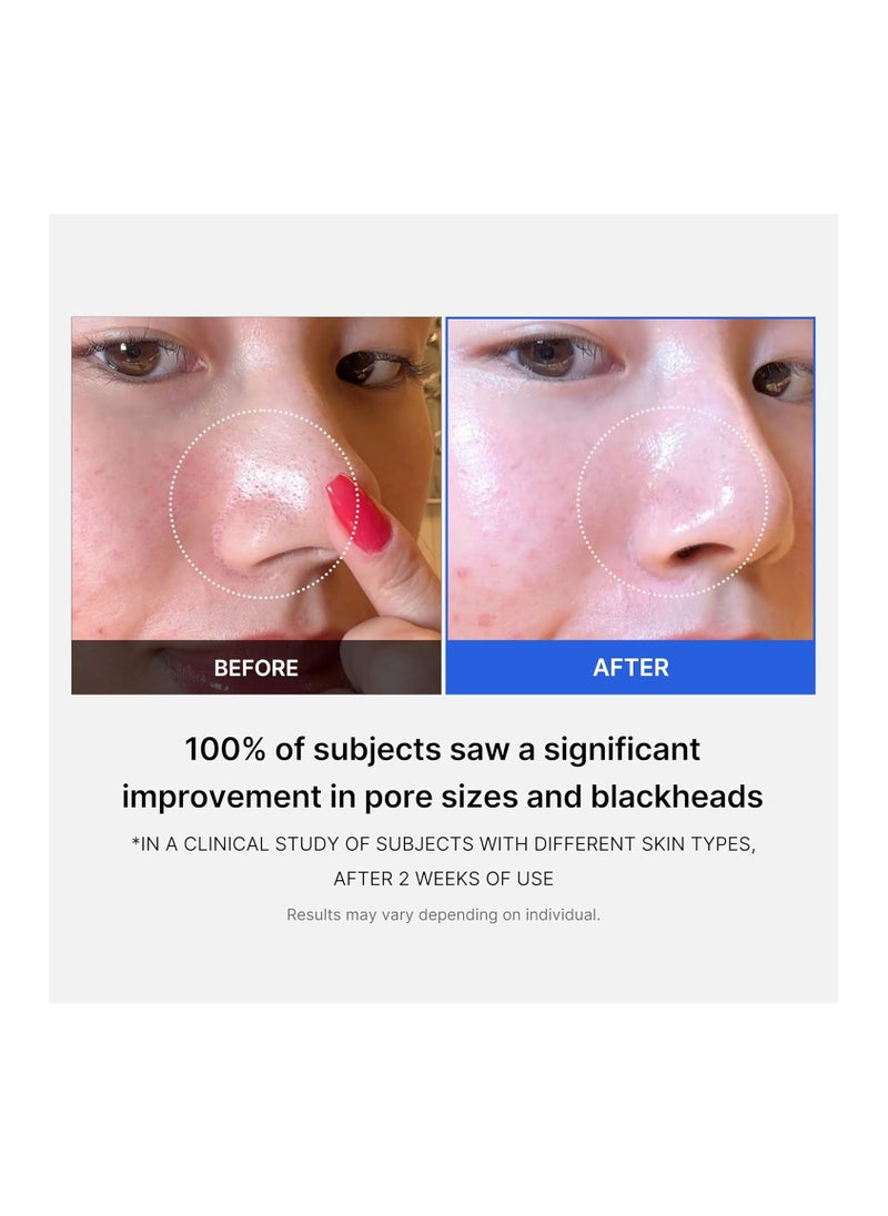 Zero Pore Pads  2.0 (70 Pads) -  Calming Toner Pads for Exfoliation, Minimizing Pores, and Blackhead Removal with PHA - Ideal for All Skin Types - Korean Skin Care