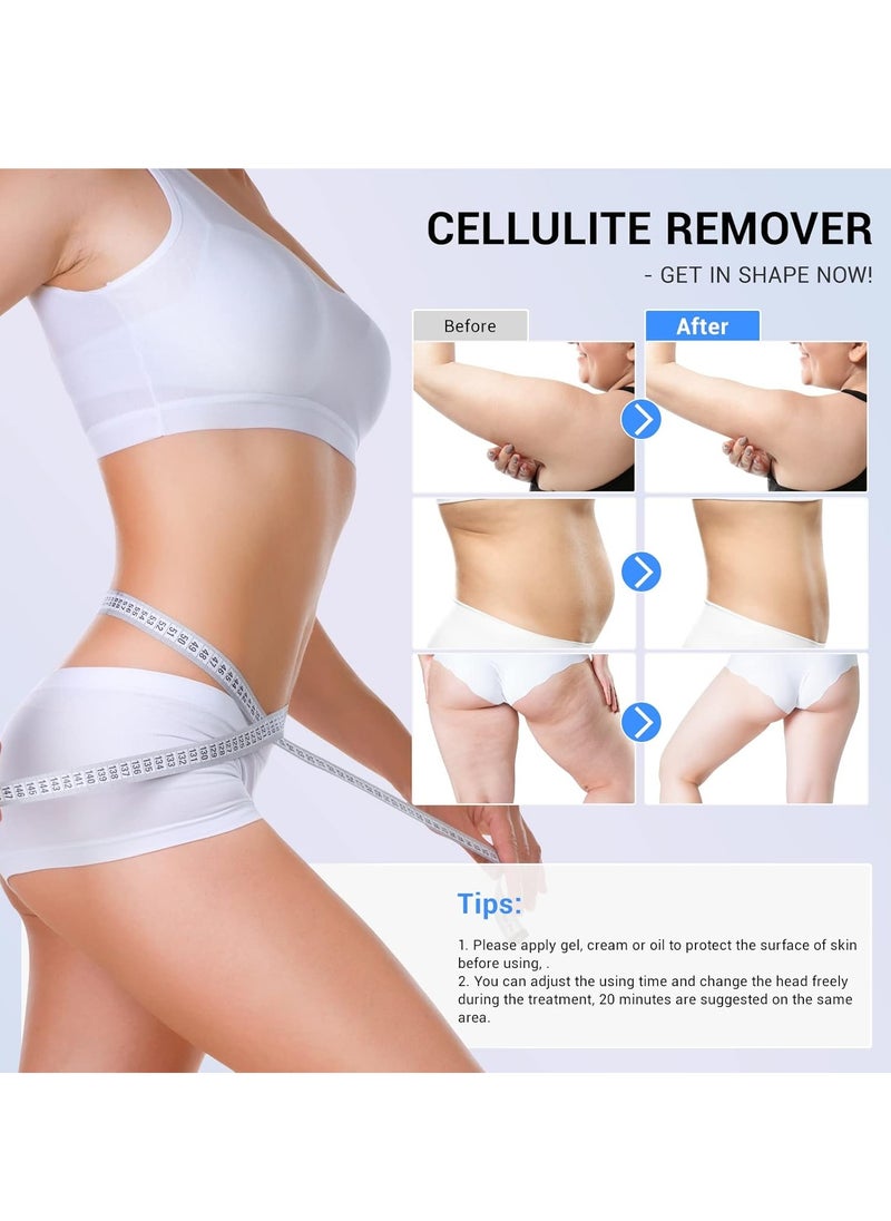 sens for Improvement in The Appearance of Cellulite Device Cellulite Massager Radio Frequency, White