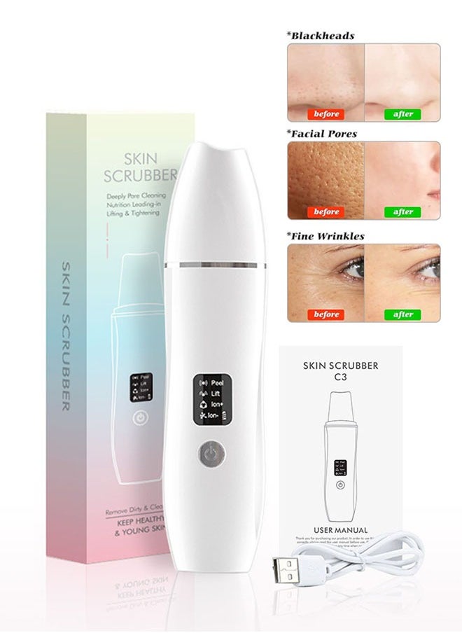 Blackhead Remover Skin Scrubber, Deep Vibrate Device, Wrinkles Face Lifting Peeling Tool, Facial Pore Cleaner Machine, Ultrasonic Skin Scraper Pore Cleanser, Tighten Skin, Acne Extractor Tool