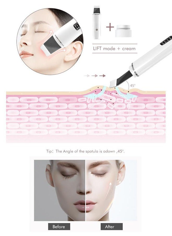 Blackhead Remover Skin Scrubber, Deep Vibrate Device, Wrinkles Face Lifting Peeling Tool, Facial Pore Cleaner Machine, Ultrasonic Skin Scraper Pore Cleanser, Tighten Skin, Acne Extractor Tool