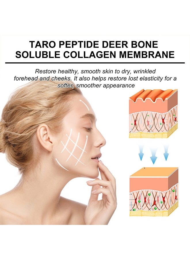 Taro Peptide Deer Bone Soluble Collagen Membrane-Forehead Fine Line Chuan Line Moisturizing Moisturizing and firming skin protein membrane, Cheek Patch *2pcs+ Forehead patch *1pcs+ Serum spray 10ml