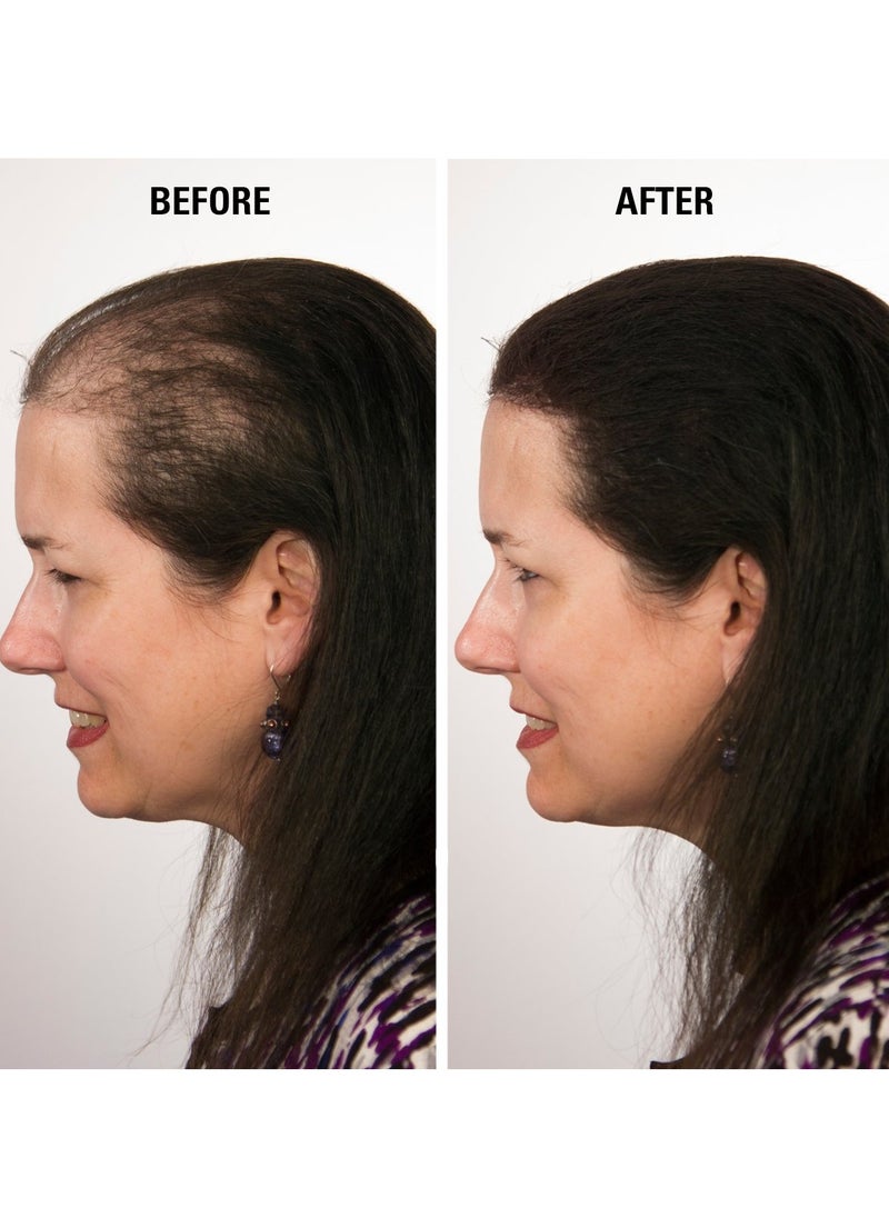 ECLIPSE Hair Fibers Dark Brown for Thinning Hair for Women & Men to Conceal Hair Loss in 15 Seconds - 100% Undetectable Hair Building Fibers, 30g