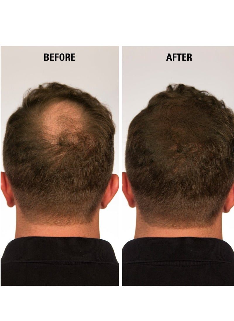ECLIPSE Hair Fibers Dark Brown for Thinning Hair for Women & Men to Conceal Hair Loss in 15 Seconds - 100% Undetectable Hair Building Fibers, 30g