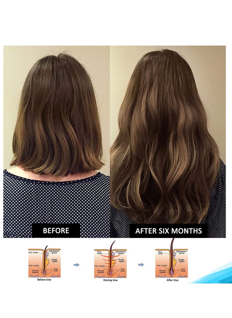 Hairgenics Pronexa Clinical Strength Hair growth & Regrowth Therapy Hair Loss Shampoo With Biotin, Collagen, and DHT Blockers for Thinning Hair, 8 fl.oz.