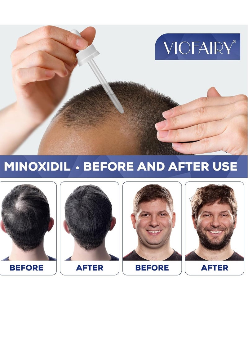 5% Minoxidil for Men and Women, Hair Regrowth Treatment for Thinning Hair and Hair Loss, Topical Solution - 1 Months Supply - Dermatologist recommended (Pack of 1)