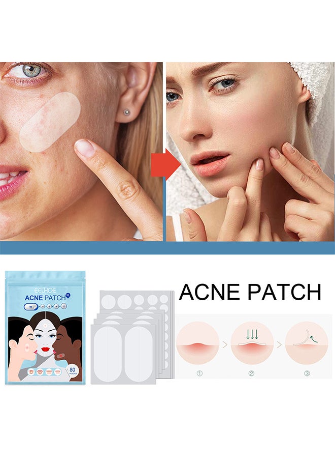 Acne Pimple Patches, 5 Sizes 80 Patches For Large Zit Breakouts, Acne Patches For Face, Chin Or Body, Acne Spot Treatment With Tea Tree And Calendula Oil, Hydrocolloid Bandages For Acne Skin