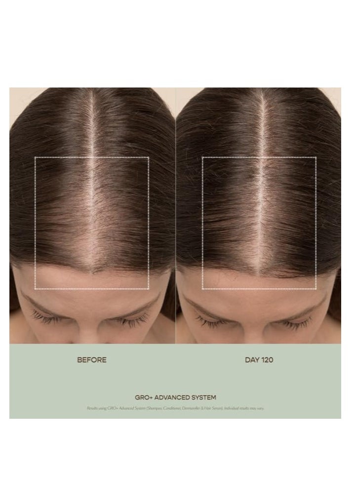 VEGAMOUR GRO+ Advanced Hair Serum | Improves Hair Density, Reduces Shedding and Promotes a Balanced Scalp | For Severe Signs of Thinning | Formulated Without Fragrance, Vegan, Cruelty-Free