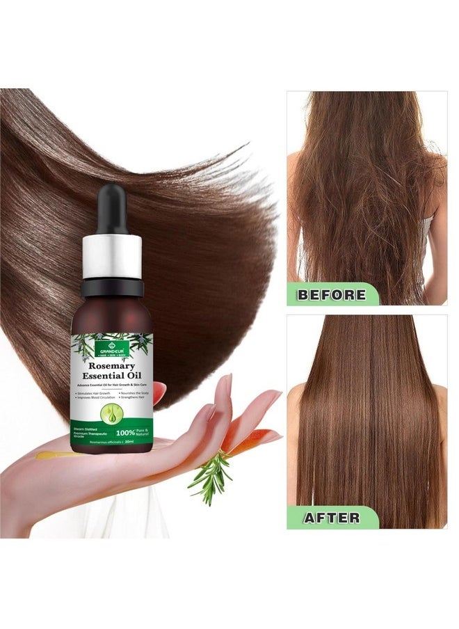 Rosemary Essential Oil For Hair Growth, Hair Fall Control & Scalp Nourishment 100% Pure, Natural, Skin Care, 90Ml (Pack Of 3)