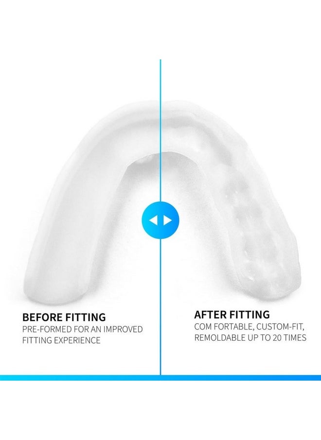 3D Night Guard - 1.6Mm Thin - Custom-Molded Fit - Protects Against Nighttime Teeth Grinding & Clenching - Odor & Taste Free - Remoldable Up To 20 Times - Non-Toxic