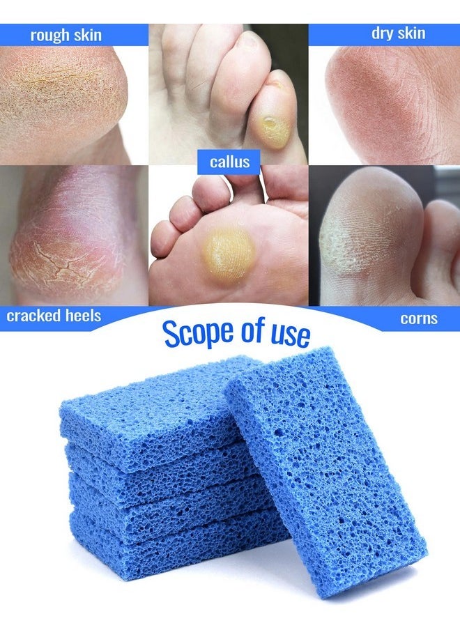 New Sharper Pumice, Professional Pedicure Tools Foot Scrubber Salon Disposable Pumice Stone Callus Remover For Feet, 40Pcs (Blue)