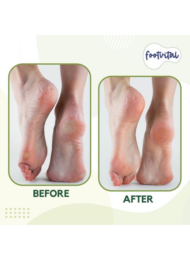 Pumice Stone For Feet, Foot Exfoliator Scrubber, Callus Remover, Made Of Natural Terra-Cotta, Exfoliates & Smooths Rough Skin