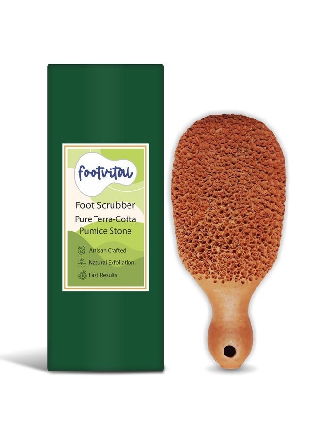 Pumice Stone For Feet, Foot Exfoliator Scrubber, Callus Remover, Made Of Natural Terra-Cotta, Exfoliates & Smooths Rough Skin
