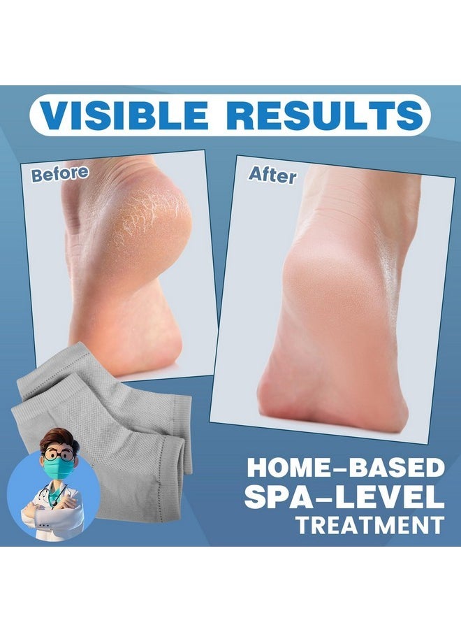 6 Pairs Moisturizing Heel Socks For Cracked Heel Treatment, Foot Care Toeless Socks To Soften And Hydrate Dry Cracked Feet Heels, Cracked Heel Repair Socks, Gel Socks For Dry Cracked Feet