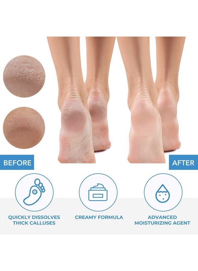 Premium Callus No More! Callus Remover, Fast-Acting Callus Removing Formula, 32 Oz.