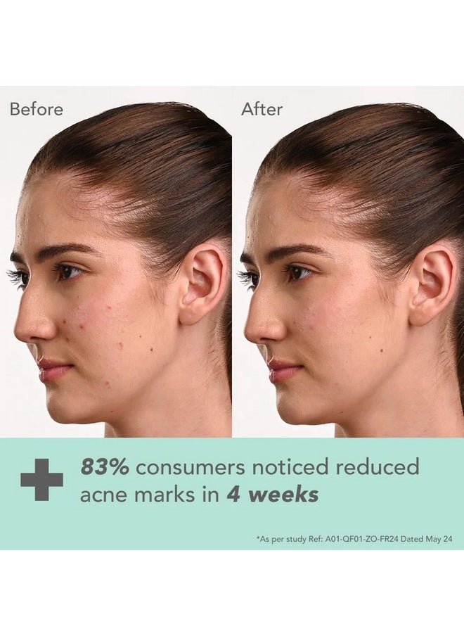 Dermabotanics Kojic Acid + Multi Berry Hi-Dose Serum | Reduces Pigmentation & Dark Spots | Calms Redness | Made With Dermatologists | Non-Irritating | Ph 5.5 | Suitable For Sensitive Skin | 28Ml