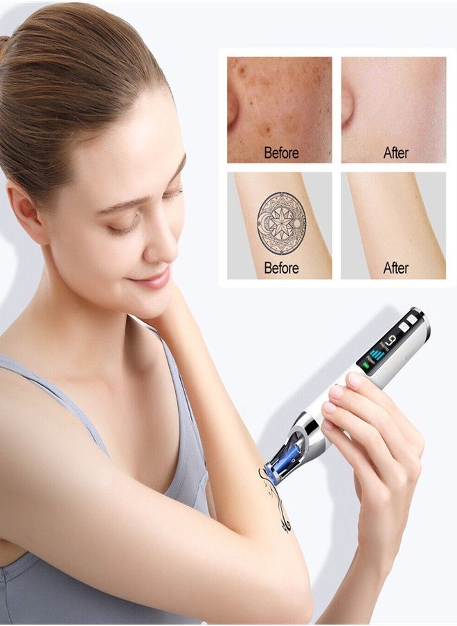 Handheld Laser Picosecond Skin Tattoo Dark Spot Removal Laser Pen Beauty Device（Blu-ray）